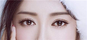 貴陽美和諧醫(yī)療美容門診部做雙眼皮術后效果