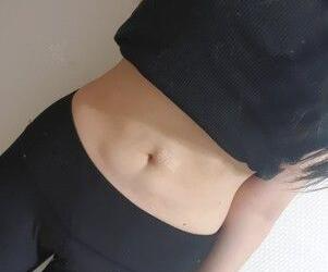 廣州星團(tuán)醫(yī)學(xué)整形醫(yī)生顧鵬做腹部吸脂效果怎么樣？顧鵬腹部吸脂案例展示
