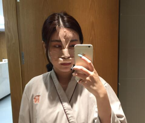 北京彤美整形醫(yī)院專家李長(zhǎng)賦做鼻部綜合整形怎么樣？
