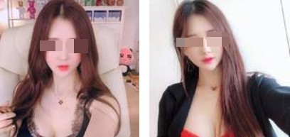 沈陽杏林整形美容醫(yī)院崔昌墉醫(yī)生做假體隆胸技術(shù)怎么樣？附案例