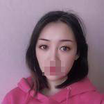 做完雙眼皮手術(shù)眼睛更加迷人了，眼睛自己會(huì)撩小哥哥