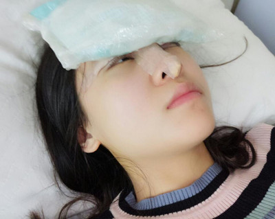 海南添美整形外科醫(yī)生王曉軍做自體軟骨隆鼻+雙眼皮+祛眼袋案例效果對(duì)比圖