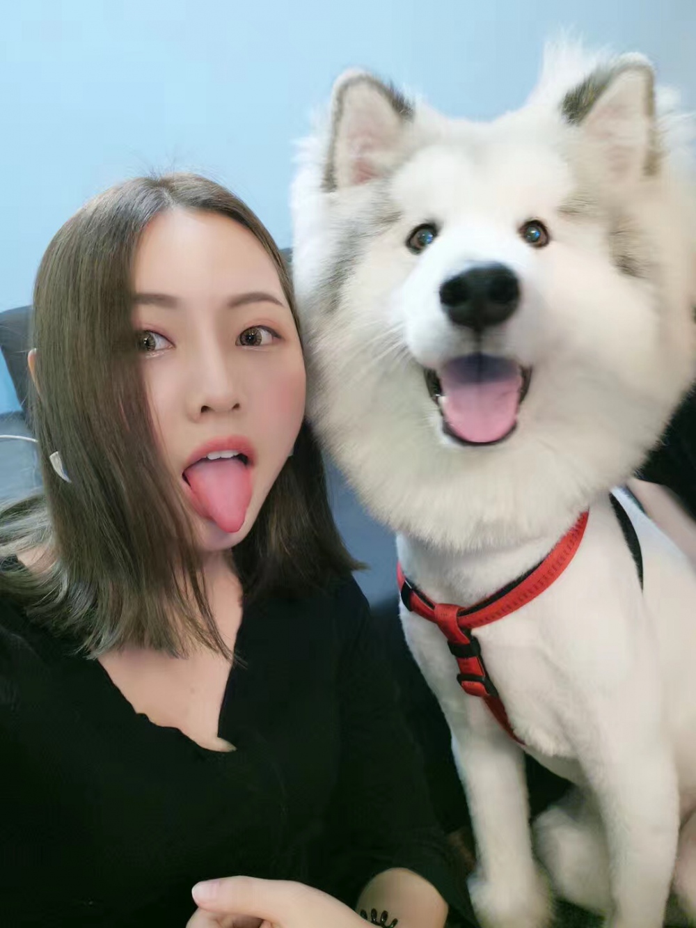 整形醫(yī)生徐長(zhǎng)亮做切開(kāi)雙眼皮案例效果對(duì)比圖