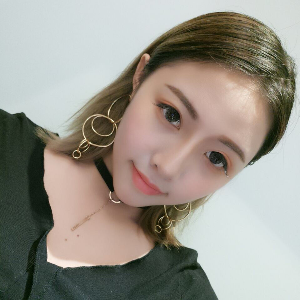 整形醫(yī)生徐長(zhǎng)亮做切開(kāi)雙眼皮案例效果對(duì)比圖