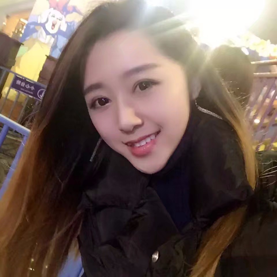 西安米蘭柏羽整形醫(yī)院李旭平做切開雙眼皮效果怎么樣？附案例