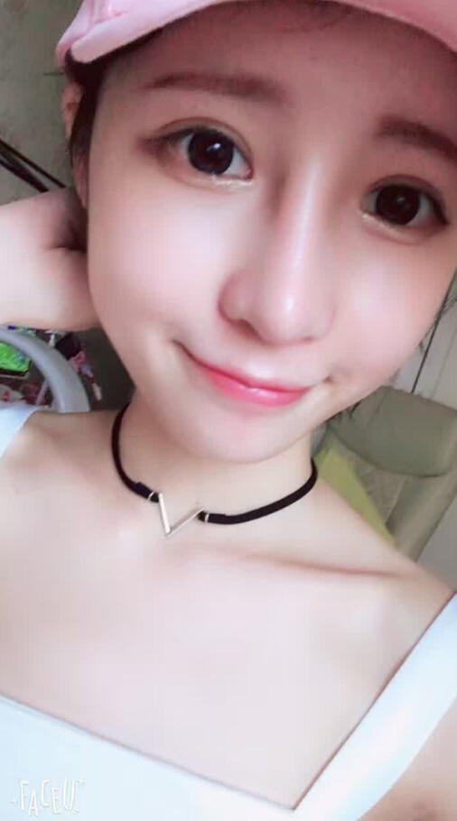長(zhǎng)沙愛思特整形醫(yī)院陳星光醫(yī)生做鼻部多項(xiàng)+自體脂肪隆鼻+切開雙眼皮+開外眼角案例