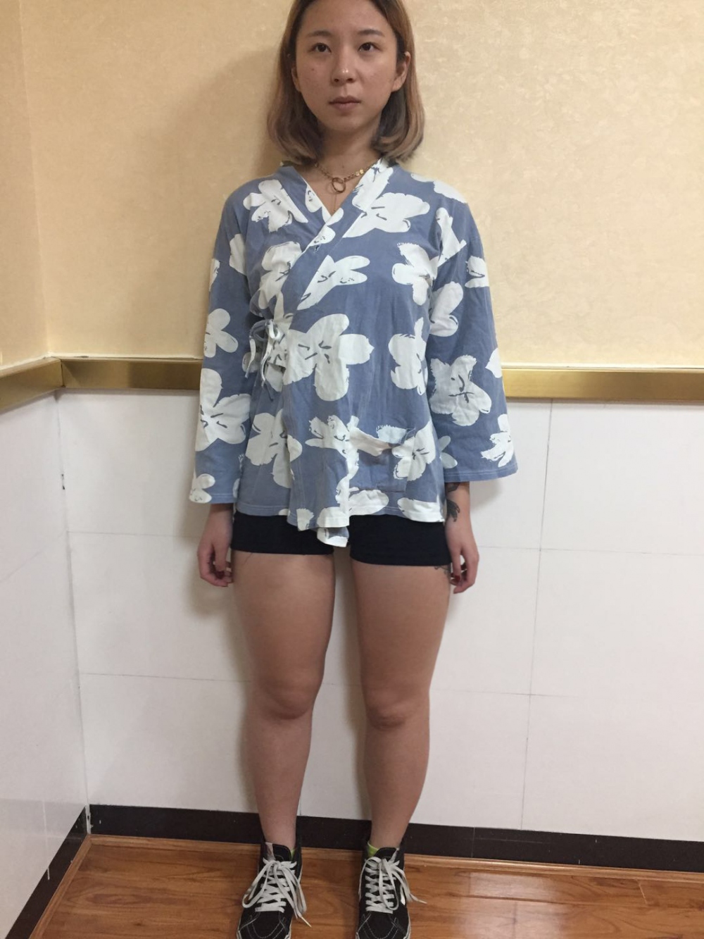 深圳鵬愛醫(yī)療整形醫(yī)生張建文做大腿吸脂怎么樣？附大腿吸脂案例效果對比圖