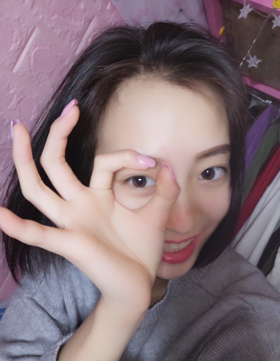 重慶樂樂欣口腔趙麗麗醫(yī)生做冷光美白效果怎么樣？附冷光美白效果對比圖