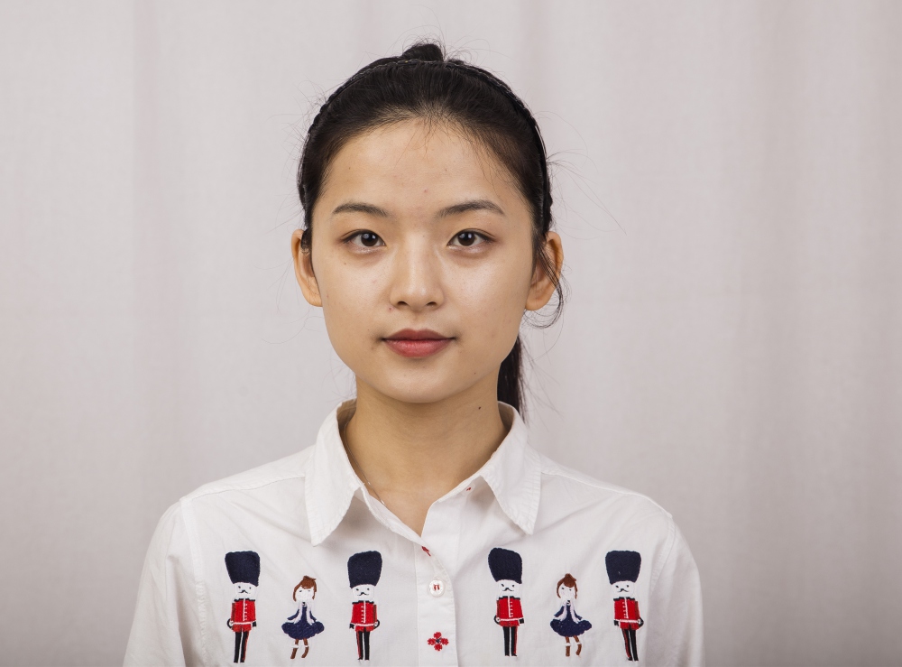鄭州名門整形醫(yī)院董斌醫(yī)生做下頜角整形怎么樣？附下頜角整形案例