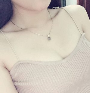 珠海萊茵醫(yī)療美容醫(yī)院崔俊溶醫(yī)生做自體脂肪隆胸效果怎么樣？附自體脂肪隆胸案例