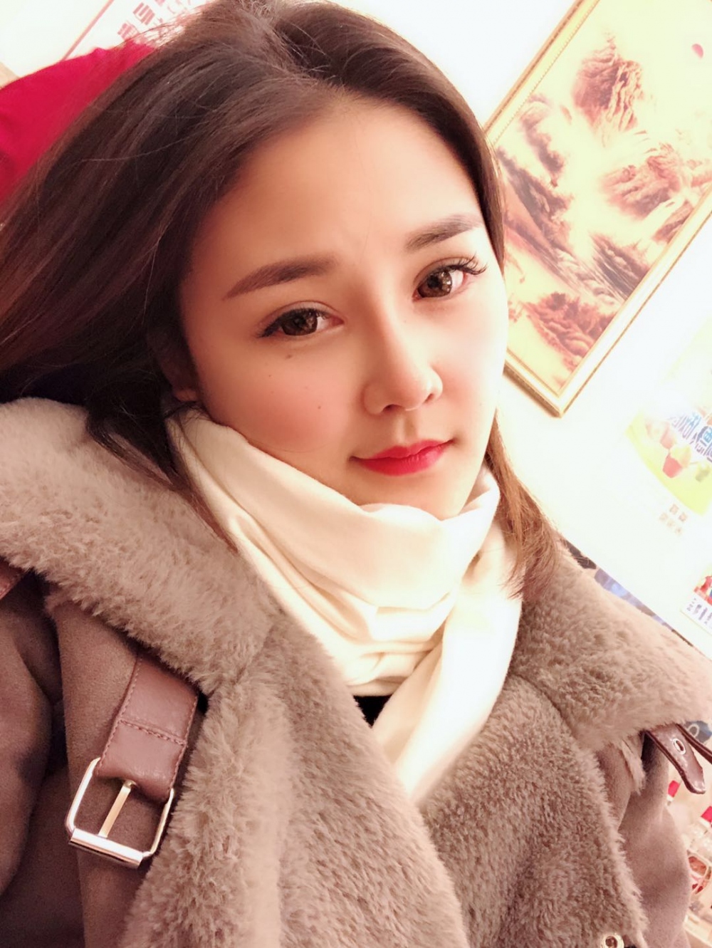 鄭州華領醫(yī)療美容醫(yī)院賀小虎醫(yī)生做眼綜合+鼻部整形手術效果怎么樣？