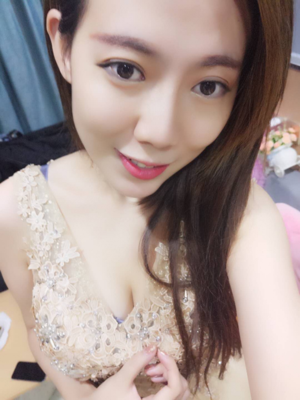 煙臺(tái)壹美整形醫(yī)院朱建瑩醫(yī)生做自體脂肪隆胸怎么樣？附自體脂肪隆胸案例