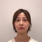 天津歐華威莎整形醫(yī)生姚玲做面部埋線提升效果怎么樣？附埋線提升案例
