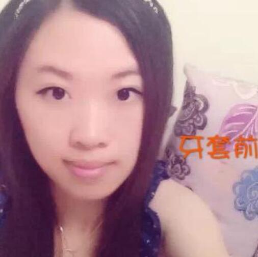 重慶嘉悅口腔醫(yī)院周繼祥醫(yī)生做金屬托槽矯正效果怎么樣？附案例效果對(duì)比圖