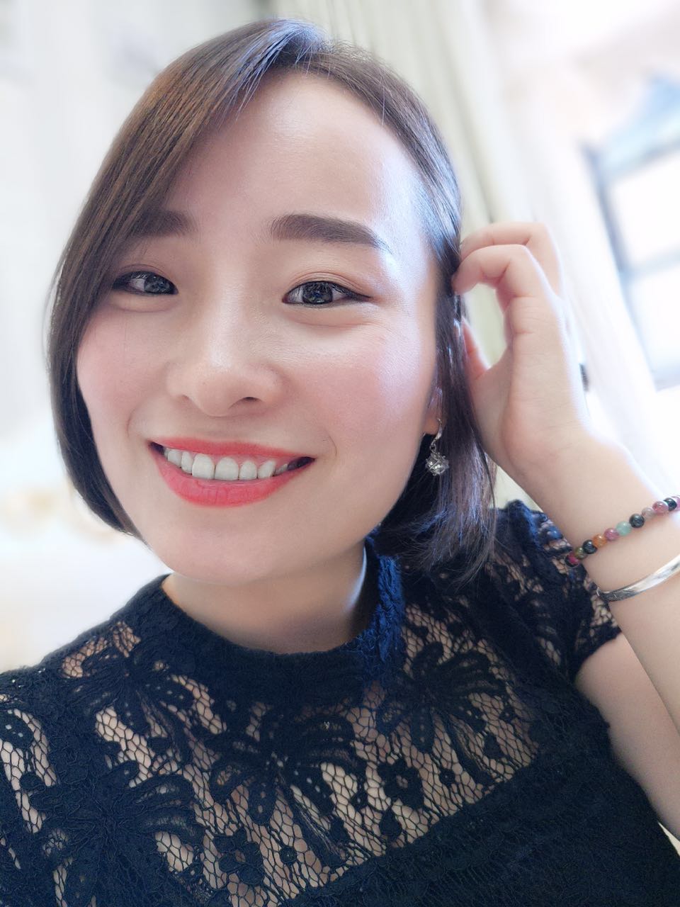 鄭州壹加壹整形醫(yī)院楊永利醫(yī)生做牙齒隱形矯正怎么樣？附牙齒隱形矯正案例