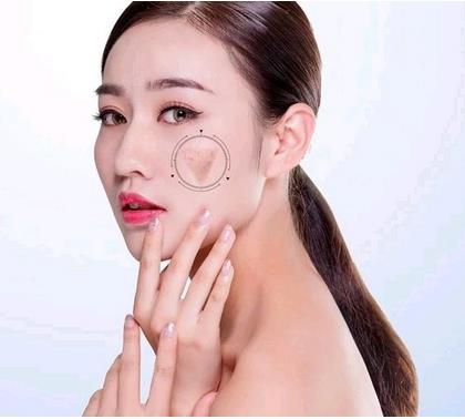 ?？诩t妝尚整形光子嫩膚