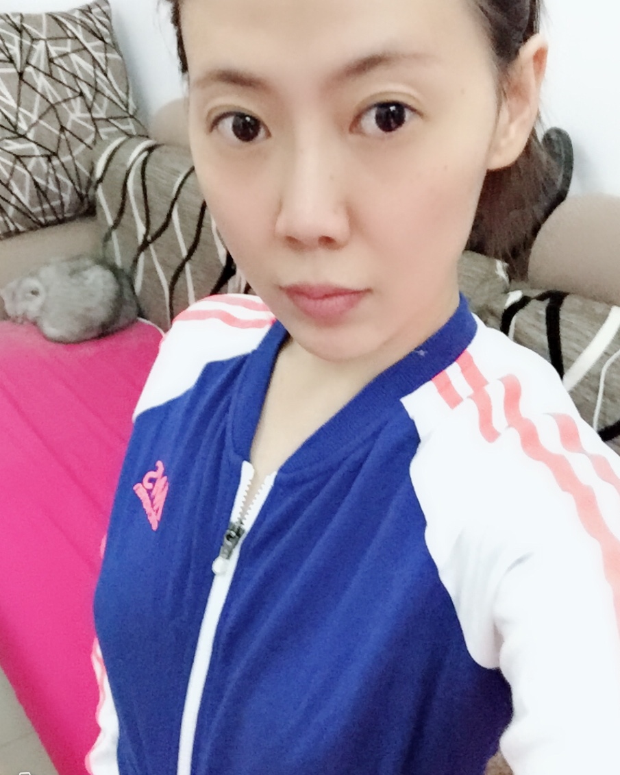煙臺(tái)壹美整形醫(yī)院朱建瑩醫(yī)生做自體脂肪隆胸怎么樣？附自體脂肪隆胸案例