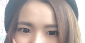 長(zhǎng)春麥西美嘉整形醫(yī)生王圣博做雙眼皮手術(shù)效果怎么樣？附雙眼皮案例