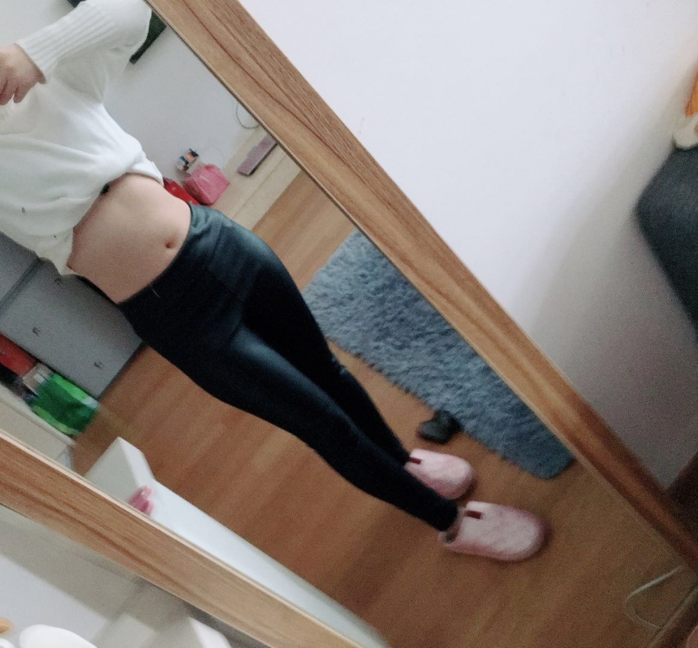 肇慶華美整形醫(yī)院陳巍醫(yī)生做腰腹吸脂效果怎么樣？附腰腹吸脂案例