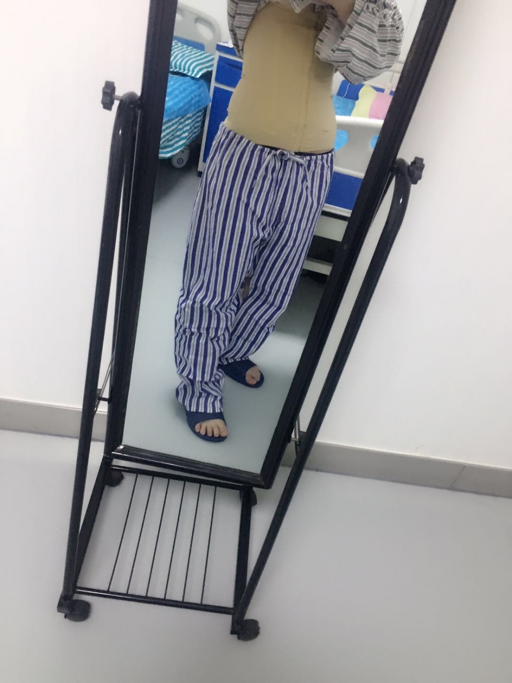 肇慶華美整形醫(yī)院陳巍醫(yī)生做腰腹吸脂效果怎么樣？附腰腹吸脂案例