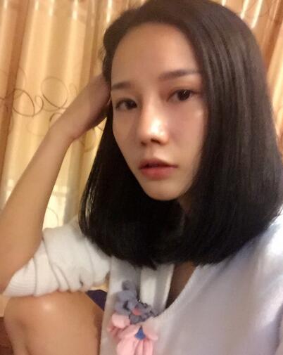 西安陽光整形醫(yī)院邵萍醫(yī)生做鼻綜合整形怎么樣？附鼻綜合整形案例