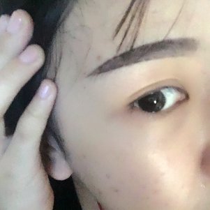 大同清木整形醫(yī)院張樹霞醫(yī)生做半永久紋眉效果如何？附半永久紋眉效果圖