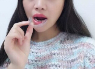 廈門拜博口腔醫(yī)院醫(yī)生張忠做牙齒隱形矯正怎么樣？附案例效果對比圖