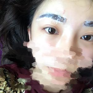 大同清木整形醫(yī)院張樹霞醫(yī)生做半永久紋眉效果如何？附半永久紋眉效果圖