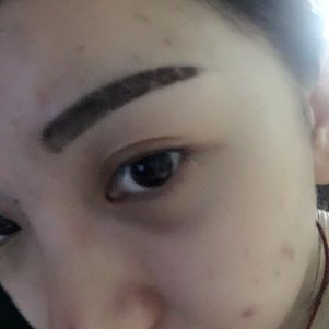 大同清木整形醫(yī)院張樹霞醫(yī)生做半永久紋眉效果如何？附半永久紋眉效果圖