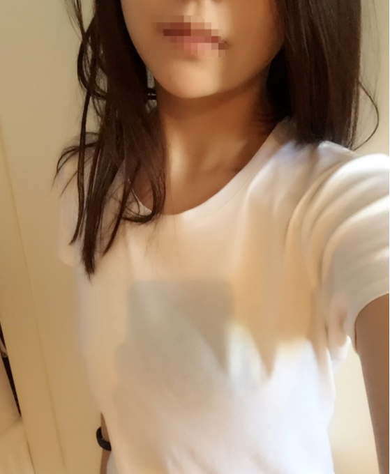 東莞韓美整形醫(yī)院醫(yī)生黃玉潔做假體隆胸怎么樣？附案例效果圖