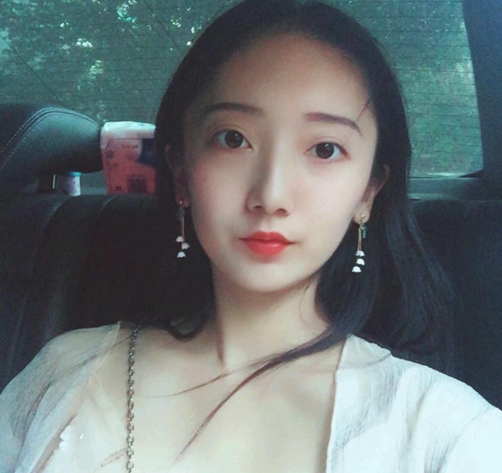 深圳鵬愛醫(yī)療美容醫(yī)院醫(yī)生文炯軫做埋線隆鼻怎么樣？附案例