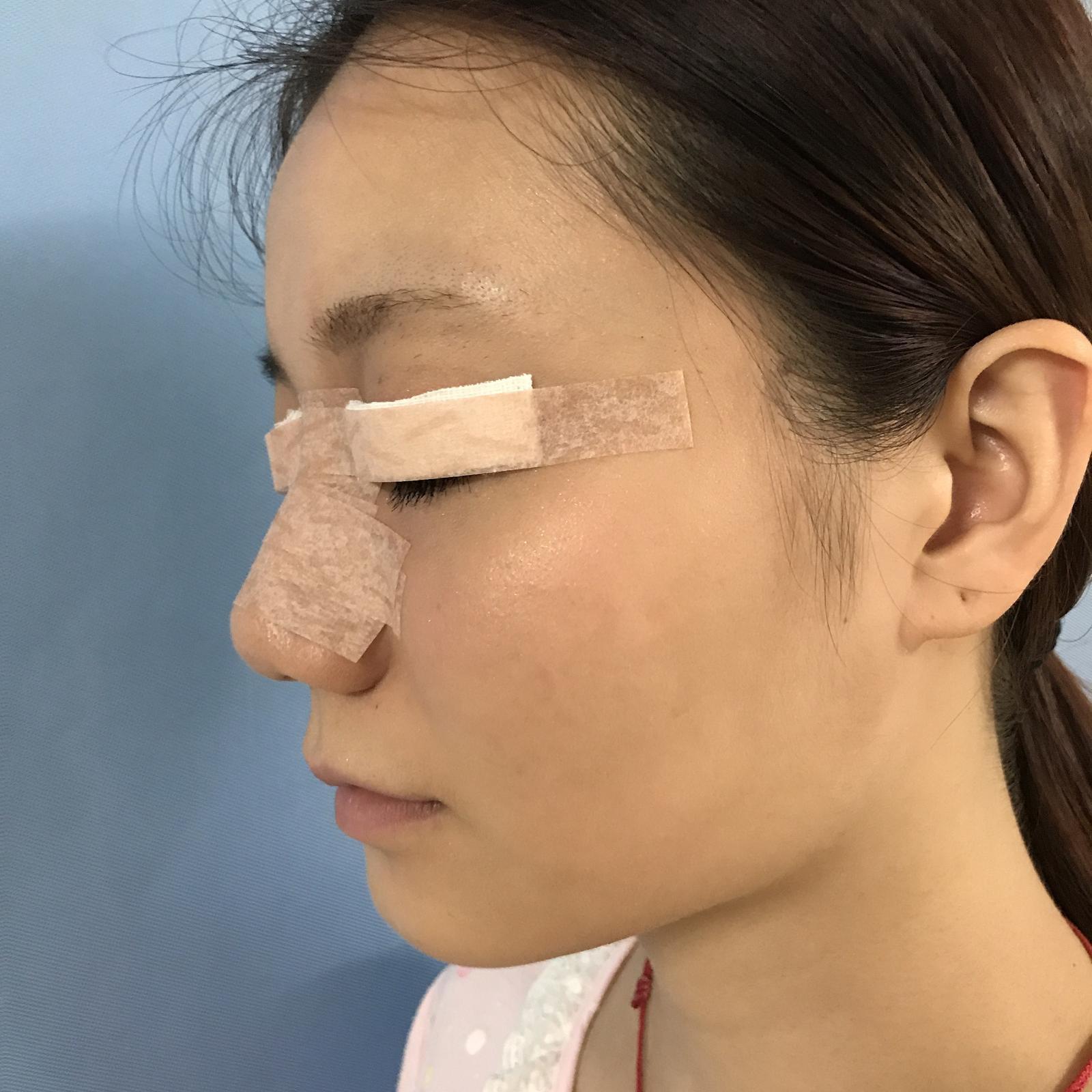 武漢華美整形醫(yī)院醫(yī)生王向陽(yáng)做眼綜合整形怎么樣？附案例效果圖