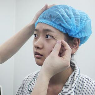 武漢伽美醫(yī)療美容醫(yī)院醫(yī)生鄭泰成做切開雙眼皮怎么樣？附案例