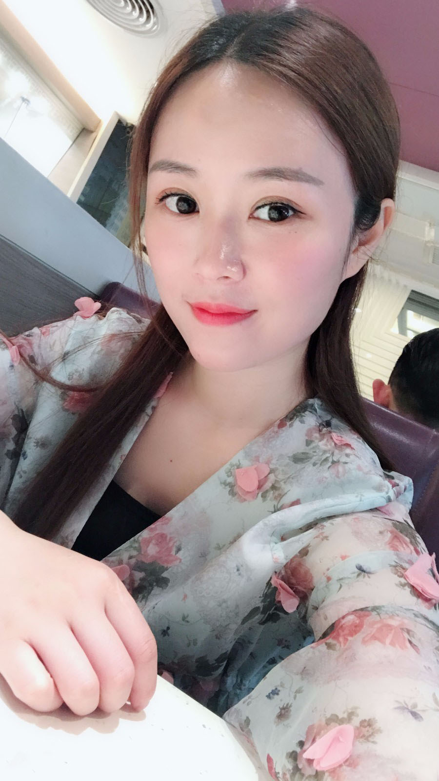 廣東韓妃醫(yī)療美容醫(yī)院做切開(kāi)雙眼怎么樣？附案例效果圖
