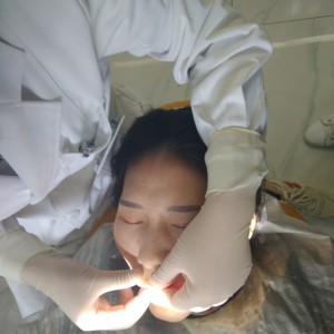 黔西南興義京州口腔醫(yī)院醫(yī)生徐勇做牙貼面怎么樣？附案例效果對(duì)比圖