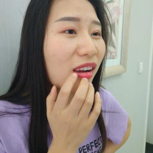 黔西南興義京州口腔醫(yī)院醫(yī)生徐勇做牙貼面怎么樣？附案例效果對(duì)比圖