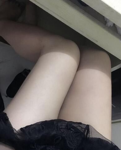 上海保加醫(yī)療美容門(mén)診部做大腿吸脂怎么樣？附楊勇醫(yī)生案例效果對(duì)比圖