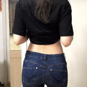 北京可思美整形醫(yī)院醫(yī)生斯勤做腰腹吸脂怎么樣？附案例效果對(duì)比圖