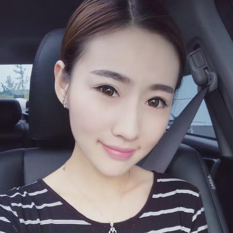 貴陽(yáng)美和諧醫(yī)療整形醫(yī)生孫澤芳做切開(kāi)雙眼皮效果怎么樣？附案例效果對(duì)比圖