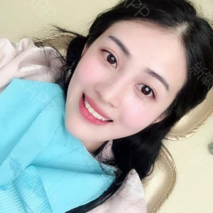 上?？仆呖谇会t(yī)院醫(yī)生鄧建儒做牙齒冷光美白怎么樣？附案例效果對比圖