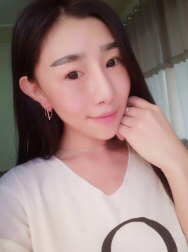 貴陽泰康樂醫(yī)院整形美容科醫(yī)生陳璐做自體脂肪全臉填充效果怎么樣？