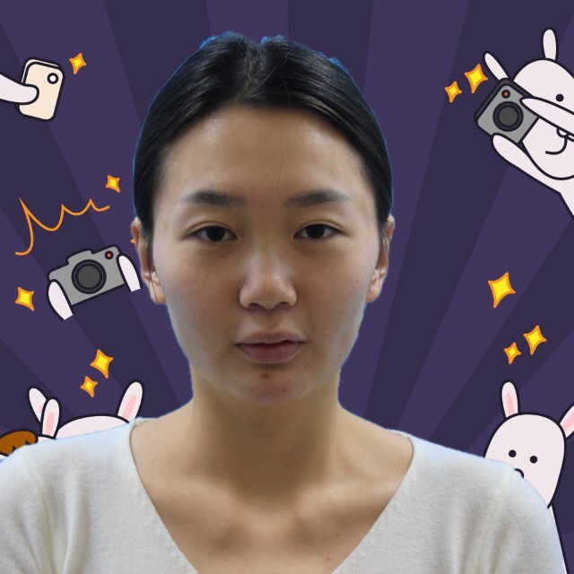 杭州格萊美整形美容醫(yī)院醫(yī)生張霞飛做自體脂肪全臉填充效果怎么樣？