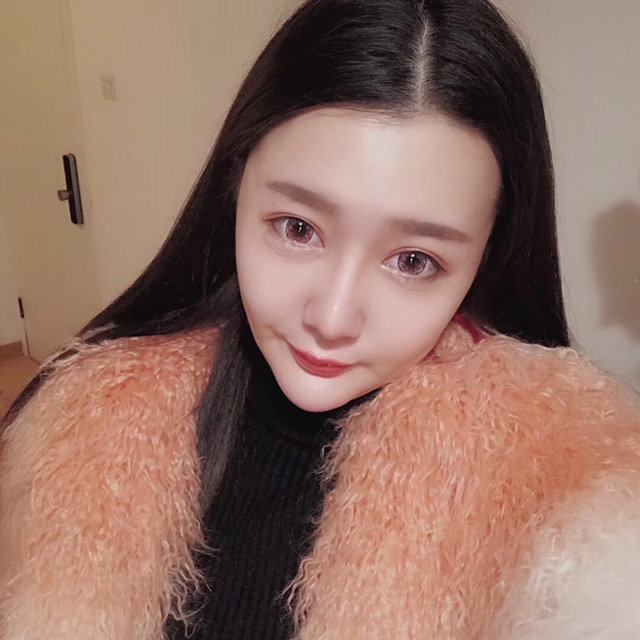 杭州格萊美整形美容醫(yī)院醫(yī)生張霞飛做自體脂肪全臉填充效果怎么樣？