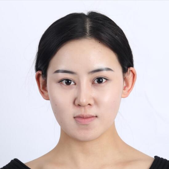 上海時(shí)光整形外科醫(yī)院醫(yī)生李靜林做假體隆鼻和反頜手術(shù)怎么樣？