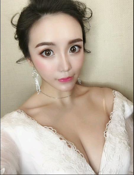 重慶當(dāng)代整形美容醫(yī)院醫(yī)生楊健做假體隆胸怎么樣？附案例