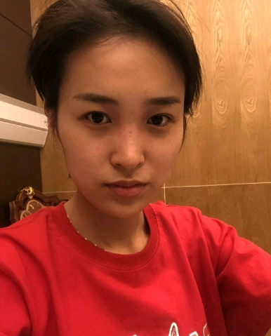 武漢米蘭醫(yī)療美容醫(yī)生柳再億做眼綜合+鼻綜合整形怎么樣？附真實(shí)案例對(duì)比圖