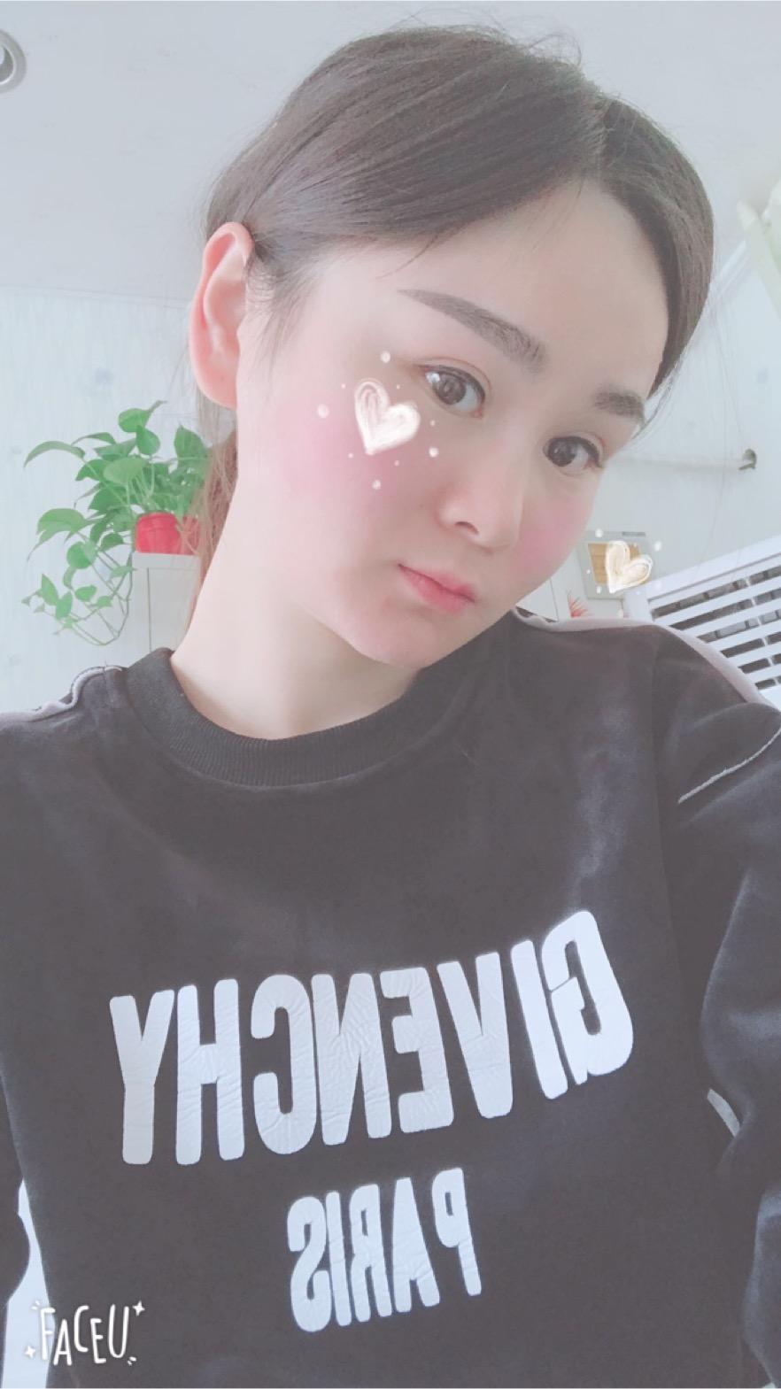 北京彤美美容整形醫(yī)院醫(yī)生楊曉惠做顴骨內(nèi)推+面部吸脂手術(shù)效果怎么樣？附案例