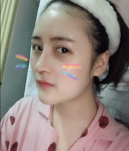 北京伊美爾美容愛康醫(yī)院醫(yī)生柳成做鼻綜合整形怎么樣？附案例效果圖