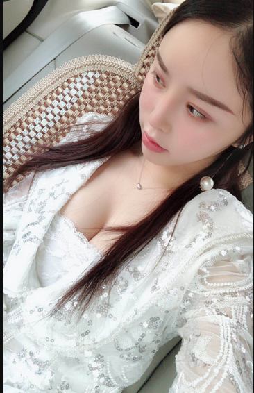 吉林現(xiàn)代整形美容醫(yī)院做假體隆胸效果怎么樣？附醫(yī)院案例效果對(duì)比圖