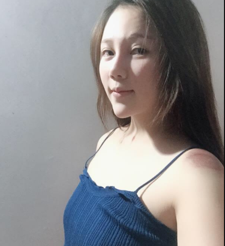 北京東方和諧醫(yī)療整形診所馮斌醫(yī)生做假體隆胸怎么樣？附案例效果對(duì)比圖